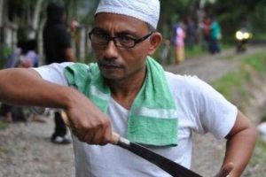 Politisi Asal Aceh Tanggung Biaya Bocah Bocor Jantung