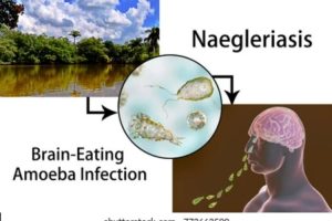 Awas Terinfeksi Naegleria fowleri, Amoeba Pemakan Otak Hidup di Air Tawar, Kenali Gejalanya